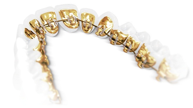 nikos spiropoulos orthodontikos esoterika siderakia